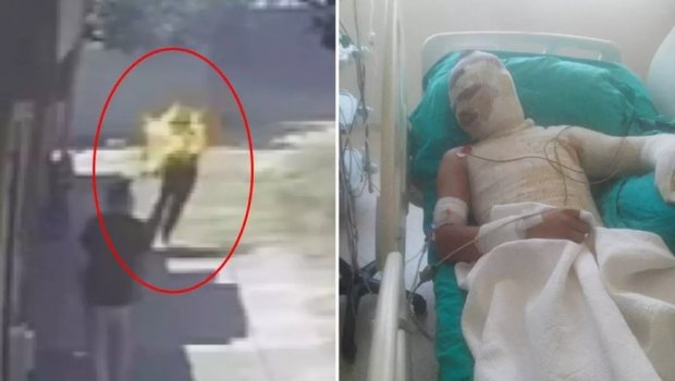 Mirasa görə qardaşı oğlunu diri-diri yandırdı - ŞOK GÖRÜNTÜLƏR