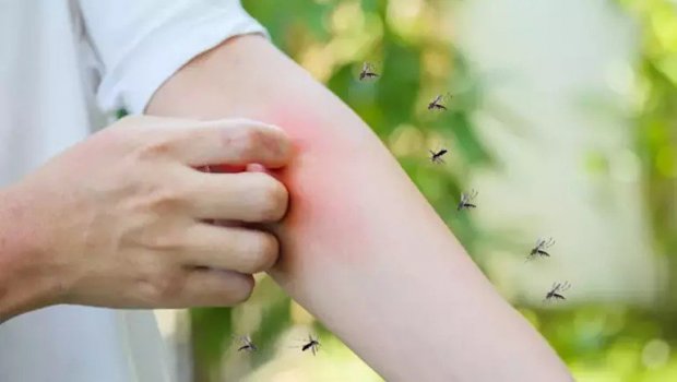 Yayda özünüzü həşəratlardan bu üsullarla qoruyun
