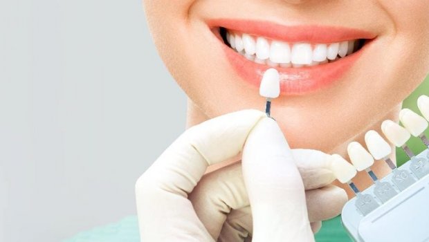 Aşağı qiymətə zirkon diş reklamlarına aldanmayın – Mütəxəssisdən VACİB XƏBƏRDARLIQ