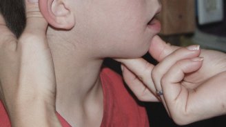 “Çöp” qalma MİFİ – Müasir tibb YOX, xalq ÜSULU?