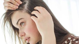Qadınlarda kişiləşmə gedir? &ndash; Həkim qadın keçəlləşməsinin səbəblərini AÇIQLADI