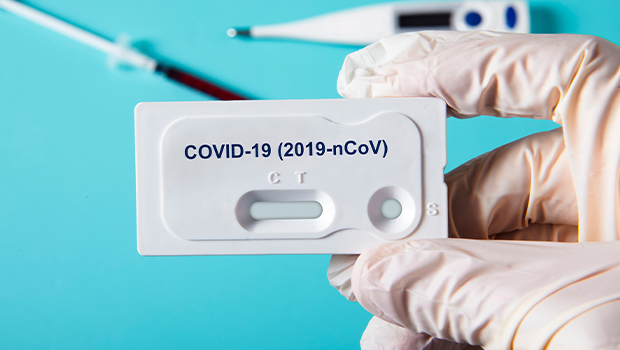 Azərbaycanda daha  803 nəfərin koronavirus testi müsbət çıxdı