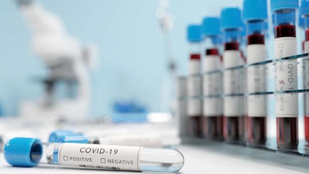 Bu gün rekord yoluxma qeydə alındı