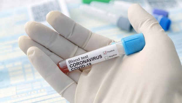 Azərbaycanda koronavirusa yoluxma sayı yenə 2000-i keçdi