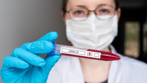 Azərbaycanda son sutkada 32 nəfər koronavirusdan ölüb