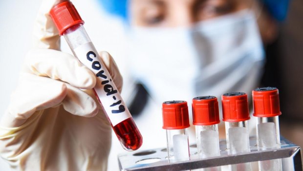 Yoluxma sayı azaldı - STATİSTİKA