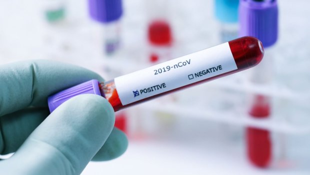 652 nəfər yeni növ virusa yoluxdu