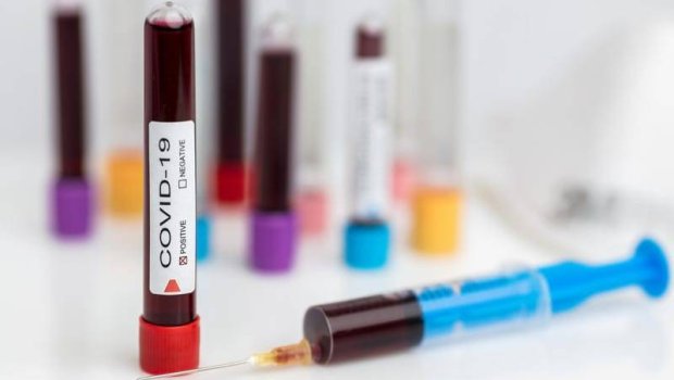 Koronavirusu ağır keçirənlər