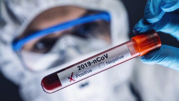 Azərbaycanda daha 322 nəfər koronavirusa yoluxdu - 11 nəfər öldü