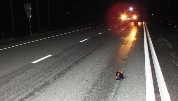 Bakıda avtomobil qadını vurdu - Ayağı sındı