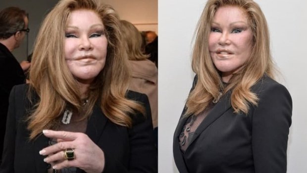 “Pişik qadın” MÜFLİS oldu – 3 villası satışa çıxarıldı