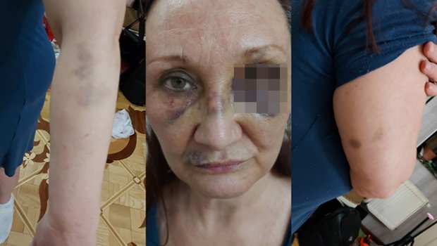 Bakıda futbolçunun qaynanası döyülərək təhdid edildi - FOTO