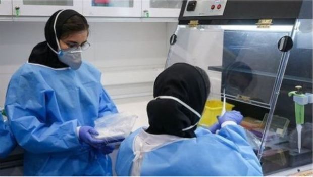 İranda ölüm sayı 76 mini keçdi 