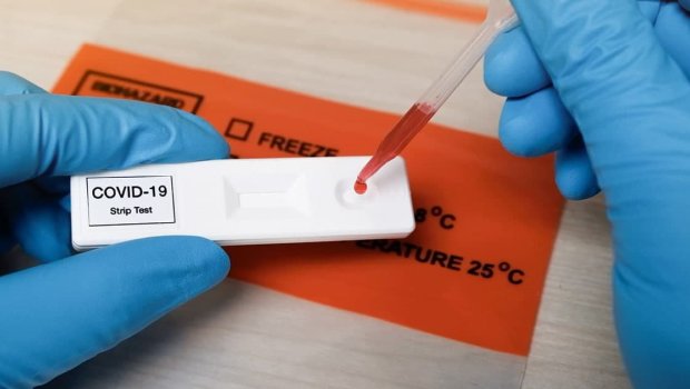 Vaksin olunmayanlara COVİD-19 testləri qadağan ediləcək