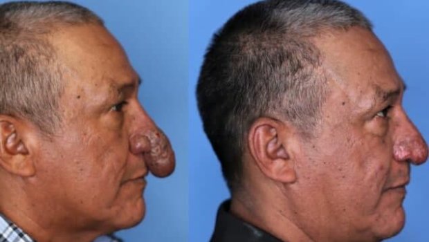 Burnu ağzına girdiyinə görə əməliyyat olundu - FOTO