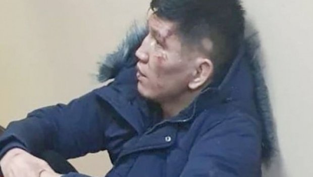 Qazaxıstanda saxlanılan MMA döyüşçüsü ağır vəziyyətdə sərbəst buraxıldı - FOTO