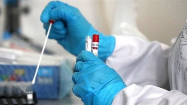 Dünyada koronavirusla bağlı SON STATİSTİKA