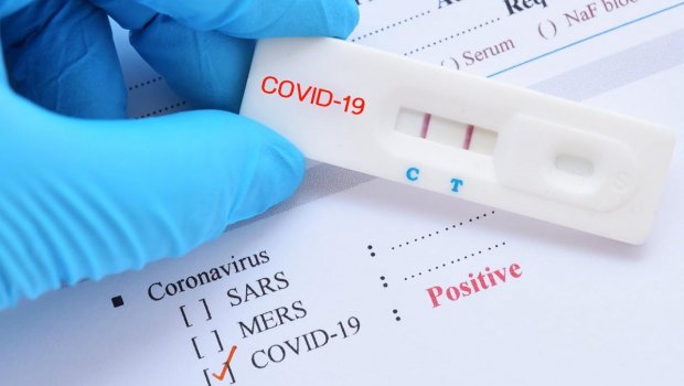 COVID testlərinin nəticələri niyə gecikir? – RƏSMİ CAVAB 