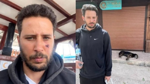 Tanınmış aktyorun üzünü it dişlədi, bu hala düşdü... - FOTO
