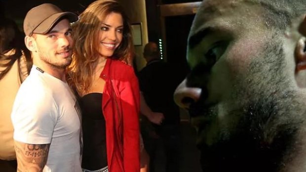 Sneyderin son görüntüsü hər kəsi təəccübləndirdi - FOTO