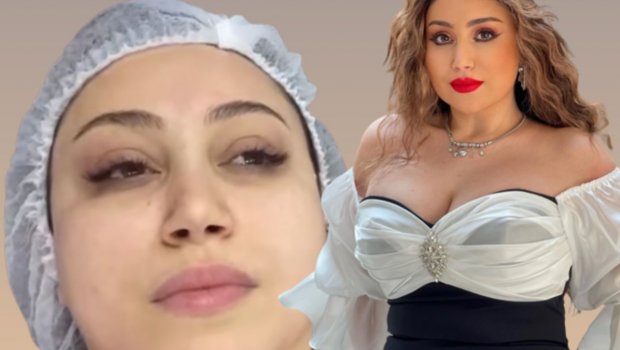 Damla 9 saatlıq plastik əməliyyatından DANIŞDI: “Sinə ölçümü və ...” - VİDEO 