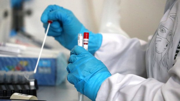 Azərbaycanda son sutkada 13 nəfər koronavirusa yoluxdu - 1 nəfər öldü