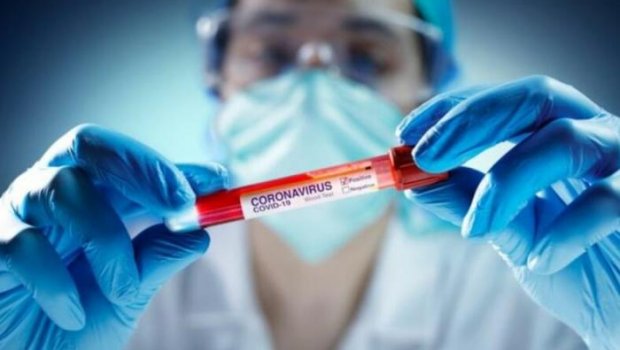 Azərbaycanda daha 11 nəfər koronavirusa yoluxdu - GÜNLÜK STATİSTİKA
