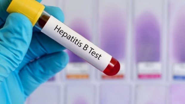Hepatit xəstələrinə pulsuz dərman verilirmi? – AÇIQLAMA