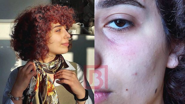 Gənc aktrisa onu döyən şəxsi bağışladı: 