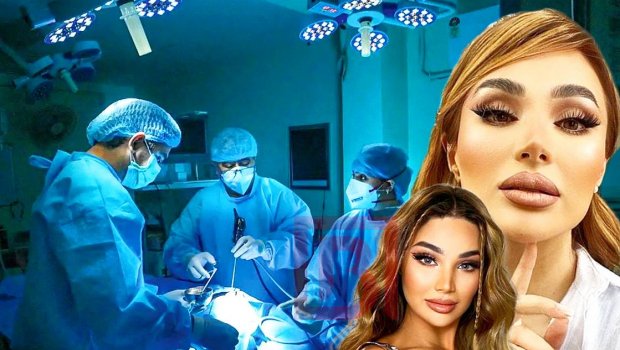 Ülviyyədən plastik əməliyyatını başına qaxınc edənlərə CAVAB: “Özümdə olana əl gəzdirmişəm” - FOTO  