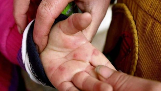 Daha bir qorxulu virus yayılır