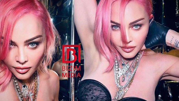 64 yaşlı Madonna gəncləşmək üçün BIÇAQ ALTINA UZANDI - FOTO 