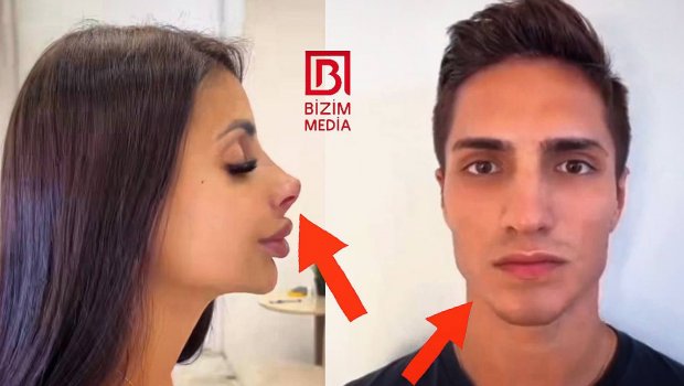 Gənclərin yeni ESTETİK TRENDİ: “Kukla burunlar, çənələr...” - FOTO/VİDEO