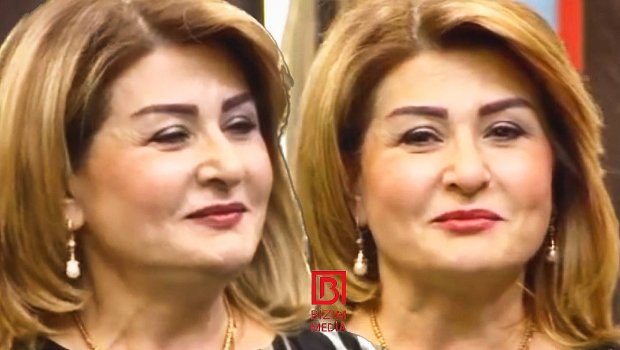Xalq artisti üzündə plastik əməliyyat keçirəcək - FOTO