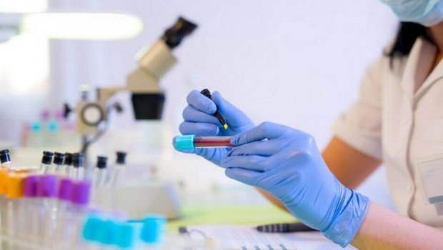 Azərbaycana yeni virusu aşkar edən testlər gətirildi