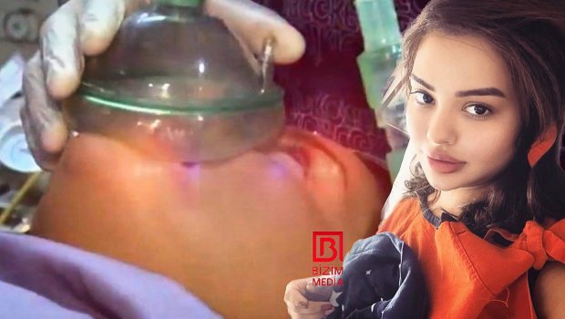 Mina Hüseyn plastik əməliyyat keçirdi - VİDEO 