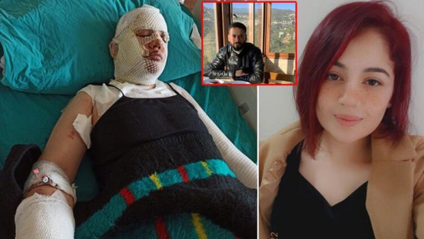 Türkiyədə DƏHŞƏT: Zəlzələdə evinə sığınan keçmiş arvadının üstünə qaynar su TÖKDÜ - FOTO/VİDEO