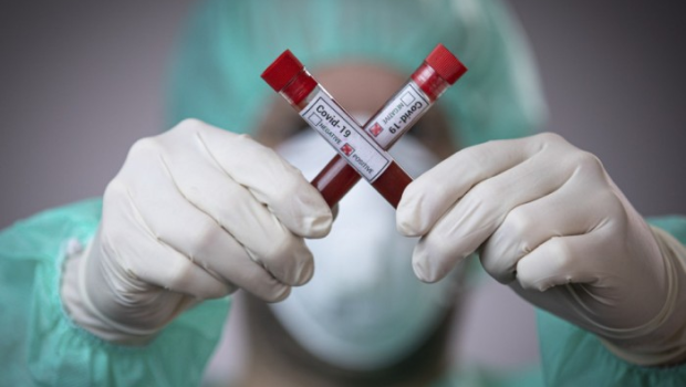 Pandemiya bu il BAŞA ÇATACAQ – ÜST  