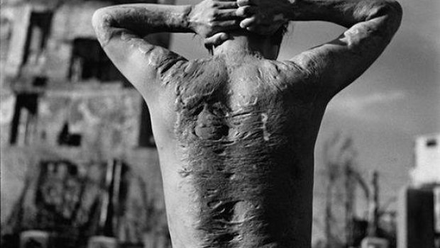 Bu gün Xirosima faciəsindən 78 il ötür