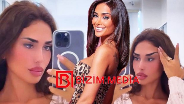 Pərvin Abıyeva növbəti dəfə estetik əməliyyat etdirdi - VİDEO  