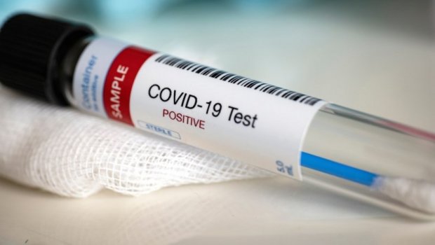 Azərbaycanda COVID-in yeni ştamları aşkarlanıb? - RƏSMİ CAVAB