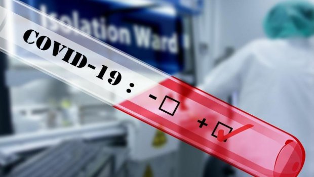 Koronavirusa yoluxma ilə bağlı gündəlik statistika niyə həftəliyə KEÇDİ? – TƏHLİL  