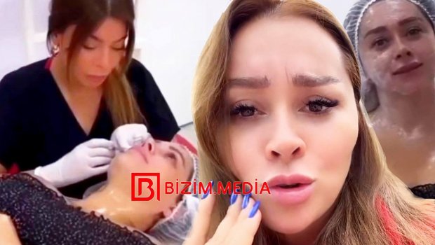 Üzünə körpə uşağın hüceyrələrini vurduran Xatirə: 