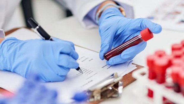 COVID-19-a yoluxma sayı bir ayda 52% artıb - ÜST 