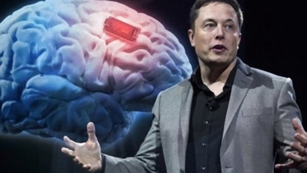 İlk dəfə insan beyninə çip yerləşdirildi - VİDEO