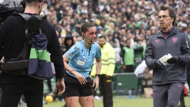 İspaniyalı hakim oyun zamanı xəsarət aldı - VİDEO