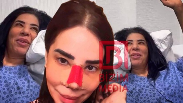 Yaşar Nurinin müğənni qızı plastik əməliyyat olundu - FOTO