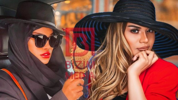 Plastik əməliyyat olunan Türkan ÜZƏ ÇIXDI – FOTO 