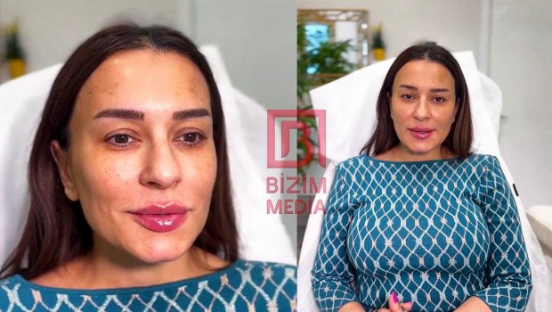 Tünzalənin estetikli görüntüsü başına BƏLA oldu - VİDEO