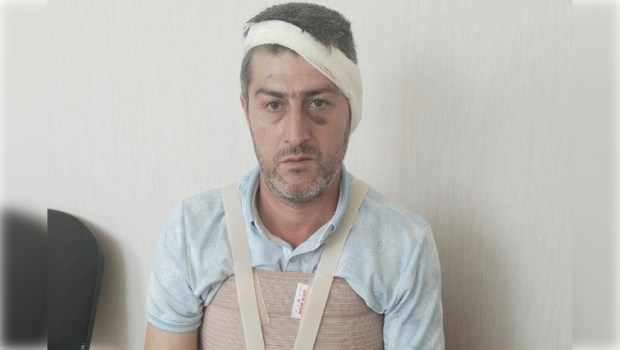 Bərdə sakininin qulağını kəsiblər? - Polis araşdırır